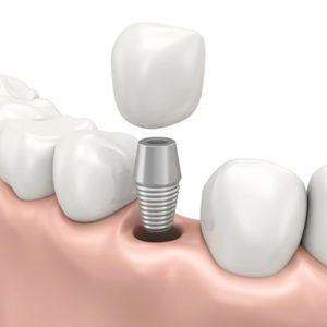 Brampton Dentist | Dr. Rachel Bell | Northlake Dentistry