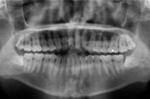 Brampton Dentist | Dr. Rachel Bell